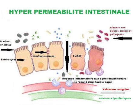 jonctionsserrées-hyperpermabilitéintestinale-emmalbnaturopathie